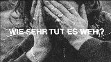 Video thumbnail Wie sehr tut es weh?